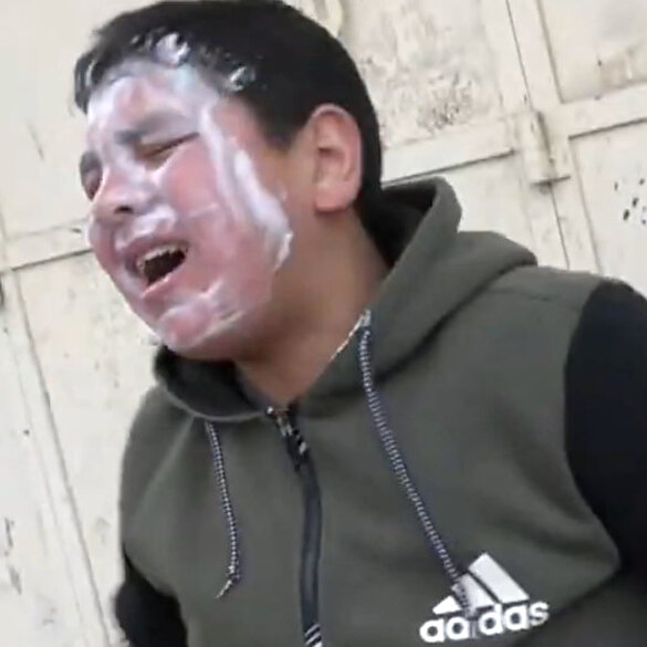 İşgalci İsrail güçleri 13 yaşındaki çocuğa biber gazıyla saldırdı